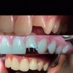 دکتر آرش غفارزاده در بروجرد