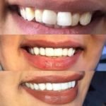 دکتر آرش غفارزاده در بروجرد