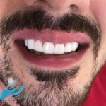 دکتر آرش غفارزاده در بروجرد