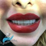 دکتر آرش غفارزاده در بروجرد