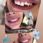 دکتر آرش غفارزاده در بروجرد