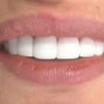 دکتر آرش غفارزاده در بروجرد