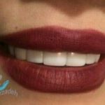 دکتر آرش غفارزاده در بروجرد