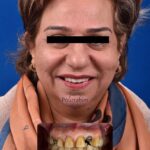 دکتر آرش پوررحیم در بندرانزلی