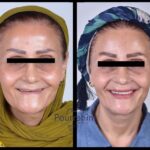 دکتر آرش پوررحیم در بندرانزلی