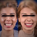 دکتر آرش پوررحیم در بندرانزلی