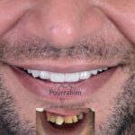 دکتر آرش پوررحیم در بندرانزلی