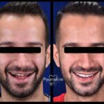 دکتر آرش پوررحیم در بندرانزلی