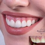 دکتر آرش پوررحیم در بندرانزلی