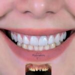 دکتر آرش پوررحیم در بندرانزلی