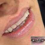 دکتر آرش پوررحیم در بندرانزلی