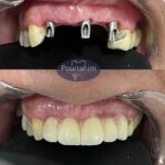 دکتر آرش پوررحیم در بندرانزلی