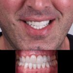 دکتر آرش پوررحیم در بندرانزلی