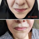 دکتر زهرا طیبی در ساوه