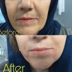 دکتر زهرا طیبی در ساوه