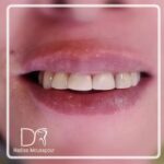 دکتر حدیثه موسی پور در لاهیجان