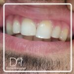 دکتر حدیثه موسی پور در لاهیجان