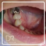 دکتر حدیثه موسی پور در لاهیجان