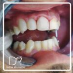 دکتر حدیثه موسی پور در لاهیجان