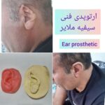 کلینیک ارتوپدی فنی سیفیه در ملایر