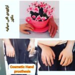 کلینیک ارتوپدی فنی سیفیه در ملایر