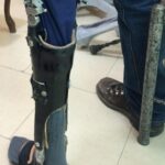 کلینیک ارتوپدی فنی صحت بخش در تبریز