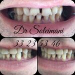 دکتر محمد سلیمانی در قزوین