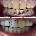 دکتر محمد سلیمانی در قزوین