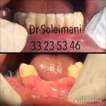 دکتر محمد سلیمانی در قزوین