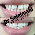 دکتر محمد سلیمانی در قزوین