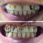 دکتر محمد سلیمانی در قزوین