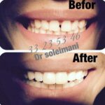 دکتر محمد سلیمانی در قزوین