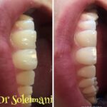 دکتر محمد سلیمانی در قزوین