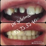 دکتر محمد سلیمانی در قزوین