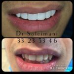 دکتر محمد سلیمانی در قزوین