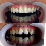 دکتر محمد سلیمانی در قزوین