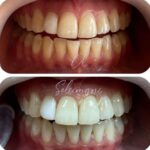 دکتر محمد سلیمانی در قزوین