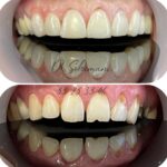 دکتر محمد سلیمانی در قزوین