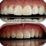 دکتر محمد سلیمانی در قزوین