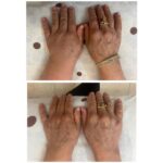 کلینیک فیزیوتراپی و لنفوتراپی آمین در یزد