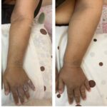 کلینیک فیزیوتراپی و لنفوتراپی آمین در یزد