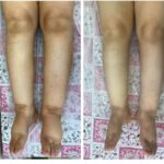 کلینیک فیزیوتراپی و لنفوتراپی آمین در یزد