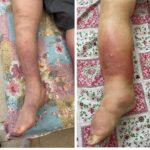 کلینیک فیزیوتراپی و لنفوتراپی آمین در یزد