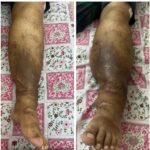 کلینیک فیزیوتراپی و لنفوتراپی آمین در یزد