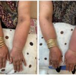 کلینیک فیزیوتراپی و لنفوتراپی آمین در یزد