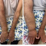 کلینیک فیزیوتراپی و لنفوتراپی آمین در یزد