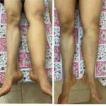 کلینیک فیزیوتراپی و لنفوتراپی آمین در یزد