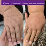 کلینیک فیزیوتراپی و لنفوتراپی آمین در یزد