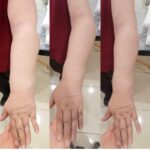 کلینیک فیزیوتراپی و لنفوتراپی آمین در یزد