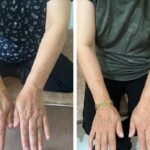 کلینیک فیزیوتراپی و لنفوتراپی آمین در یزد